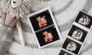 two lines of ultrasound photos and a stuffed lion on a grey and white knit rug